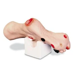Piede con ferite - Erler Zimmer